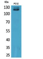 UBA1 Rabbit Polyclonal Antibody