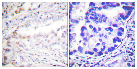 UBA2 Rabbit Polyclonal Antibody