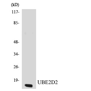 UBE2D2 Rabbit Polyclonal Antibody