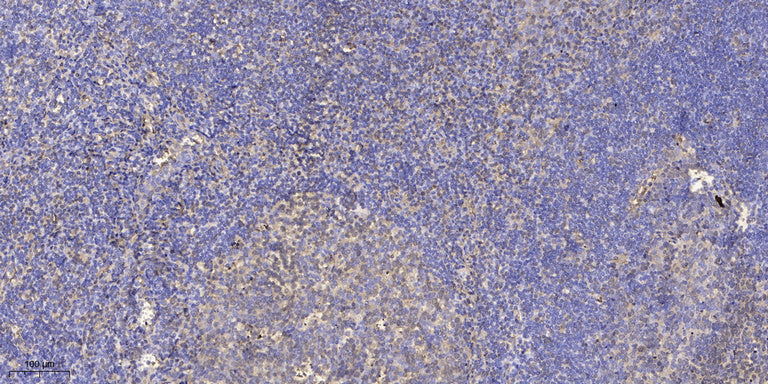 UBE2G1 Rabbit Polyclonal Antibody