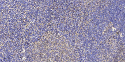 UBE2G1 Rabbit Polyclonal Antibody