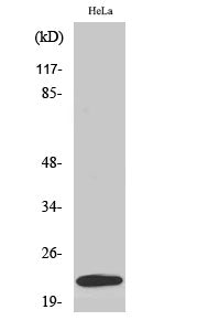 UBE2T Rabbit Polyclonal Antibody