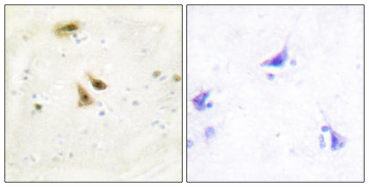 UBF-1 Rabbit Polyclonal Antibody