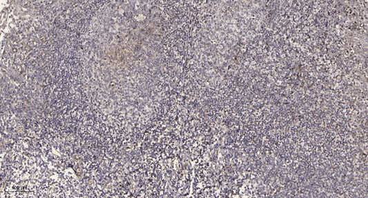 UBP34 Rabbit Polyclonal Antibody