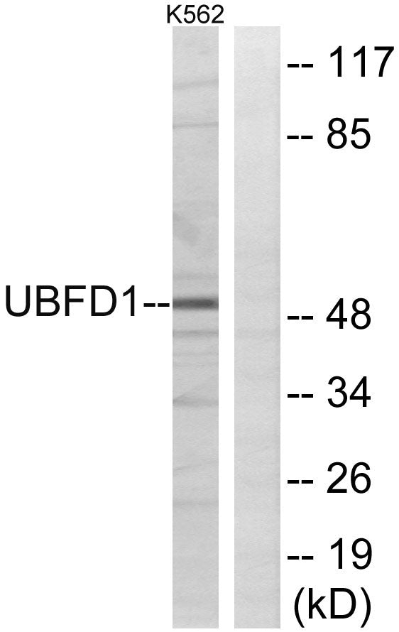 UBPH Rabbit Polyclonal Antibody
