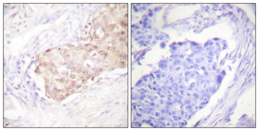UBR5 Rabbit Polyclonal Antibody
