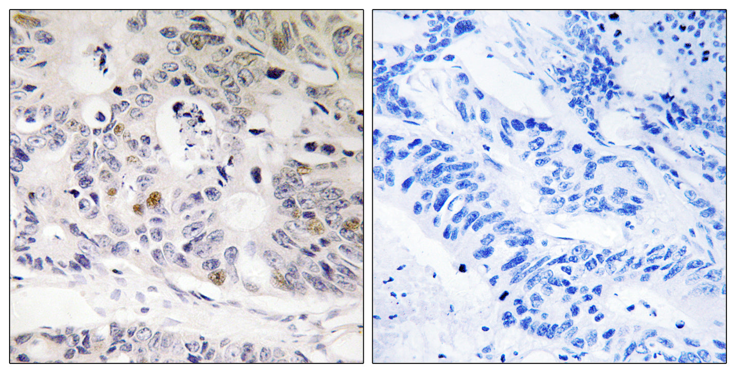 UBTD1 Rabbit Polyclonal Antibody