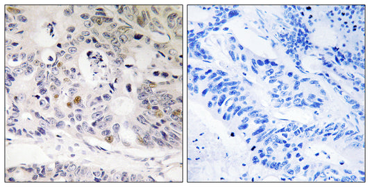 UBTD1 Rabbit Polyclonal Antibody
