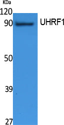 UHRF1 Rabbit Polyclonal Antibody