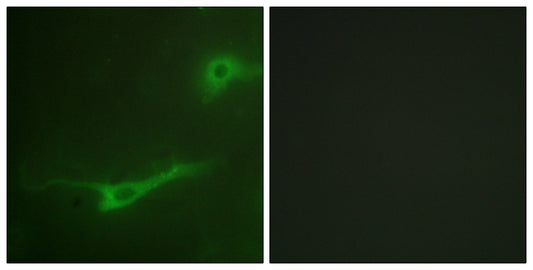 Unc18-1 Rabbit Polyclonal Antibody
