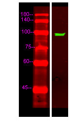 UNC5C Rabbit Polyclonal Antibody