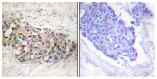 USF-2 Rabbit Polyclonal Antibody