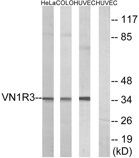 V1RL3 Rabbit Polyclonal Antibody
