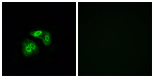 V1RL5 Rabbit Polyclonal Antibody