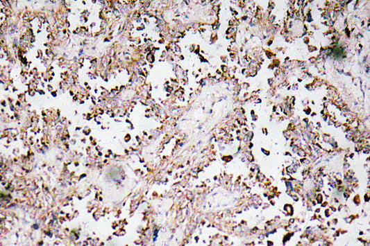 VAMP-1/2/3 Rabbit Polyclonal Antibody