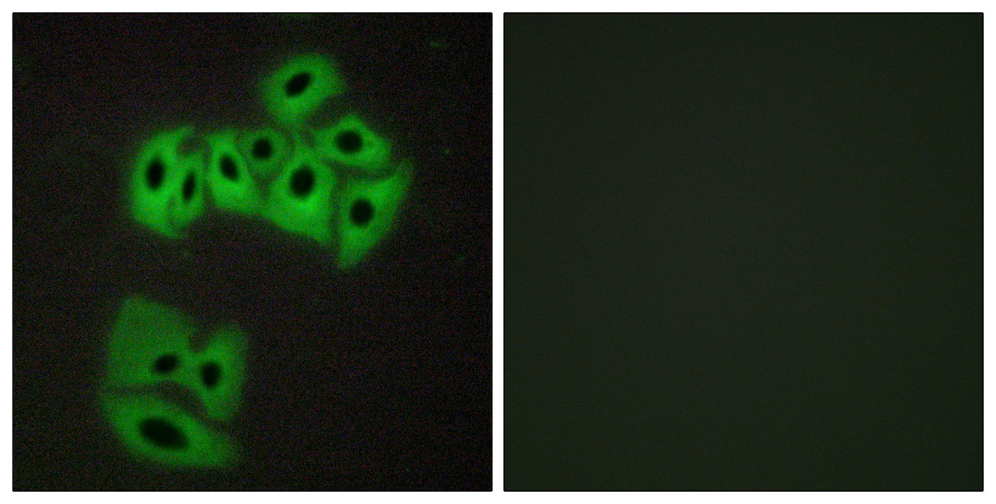 VAMP-4 Rabbit Polyclonal Antibody
