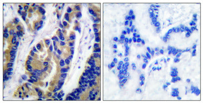 VASP Rabbit Polyclonal Antibody