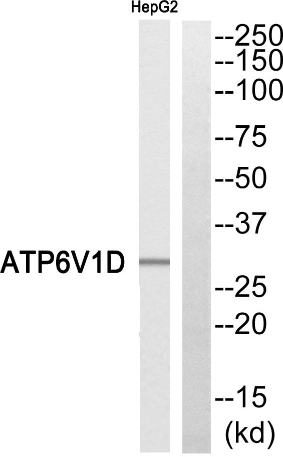 V-ATPase D Rabbit Polyclonal Antibody