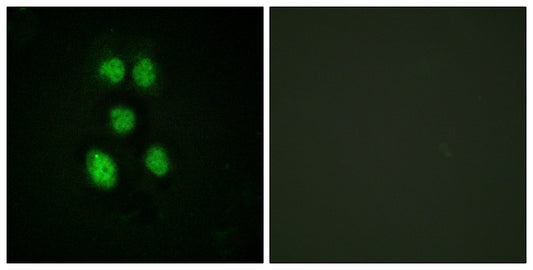 VAV1 Rabbit Polyclonal Antibody