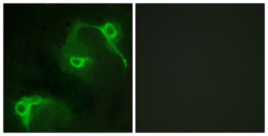 Vav2 Rabbit Polyclonal Antibody