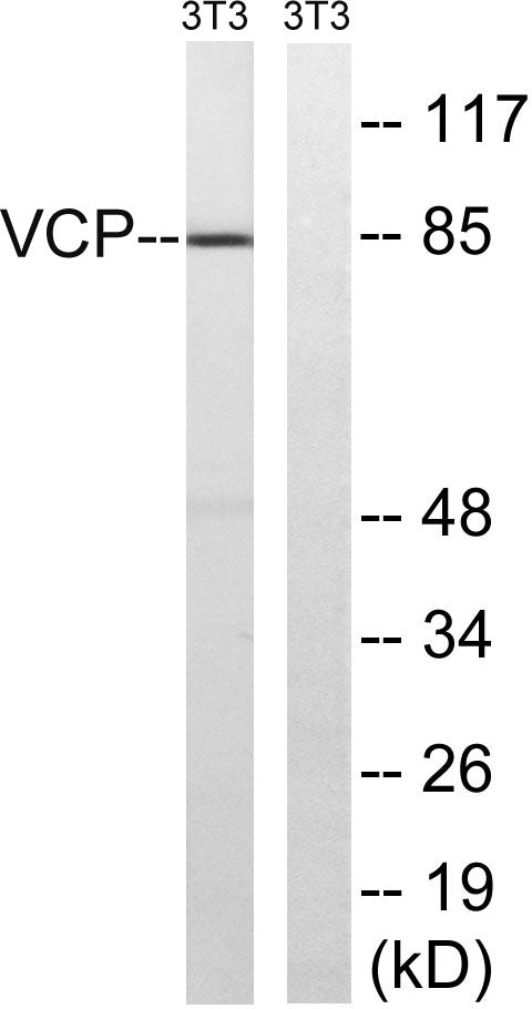 VCP Rabbit Polyclonal Antibody