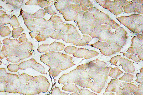 VEGF-A Rabbit Polyclonal Antibody