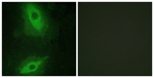 VEGI Rabbit Polyclonal Antibody