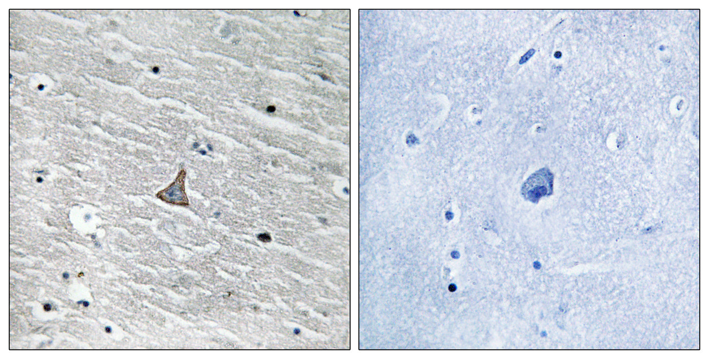 VHL Rabbit Polyclonal Antibody