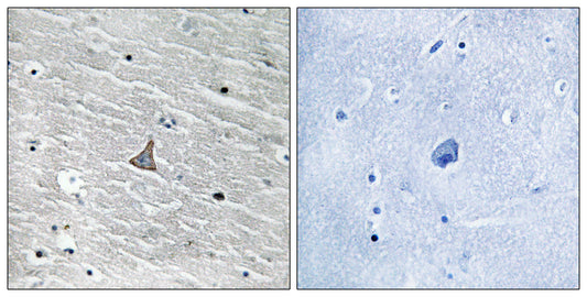 VHL Rabbit Polyclonal Antibody