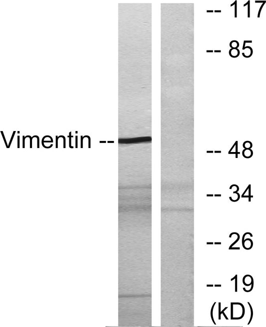 Vimentin Rabbit Polyclonal Antibody