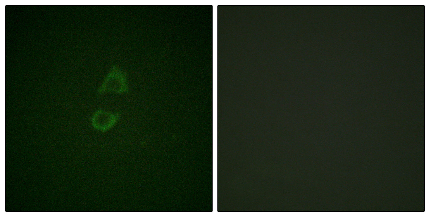 Vinculin Rabbit Polyclonal Antibody