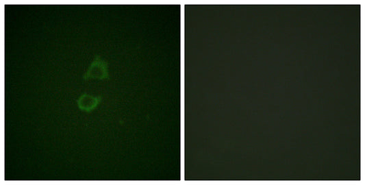 Vinculin Rabbit Polyclonal Antibody
