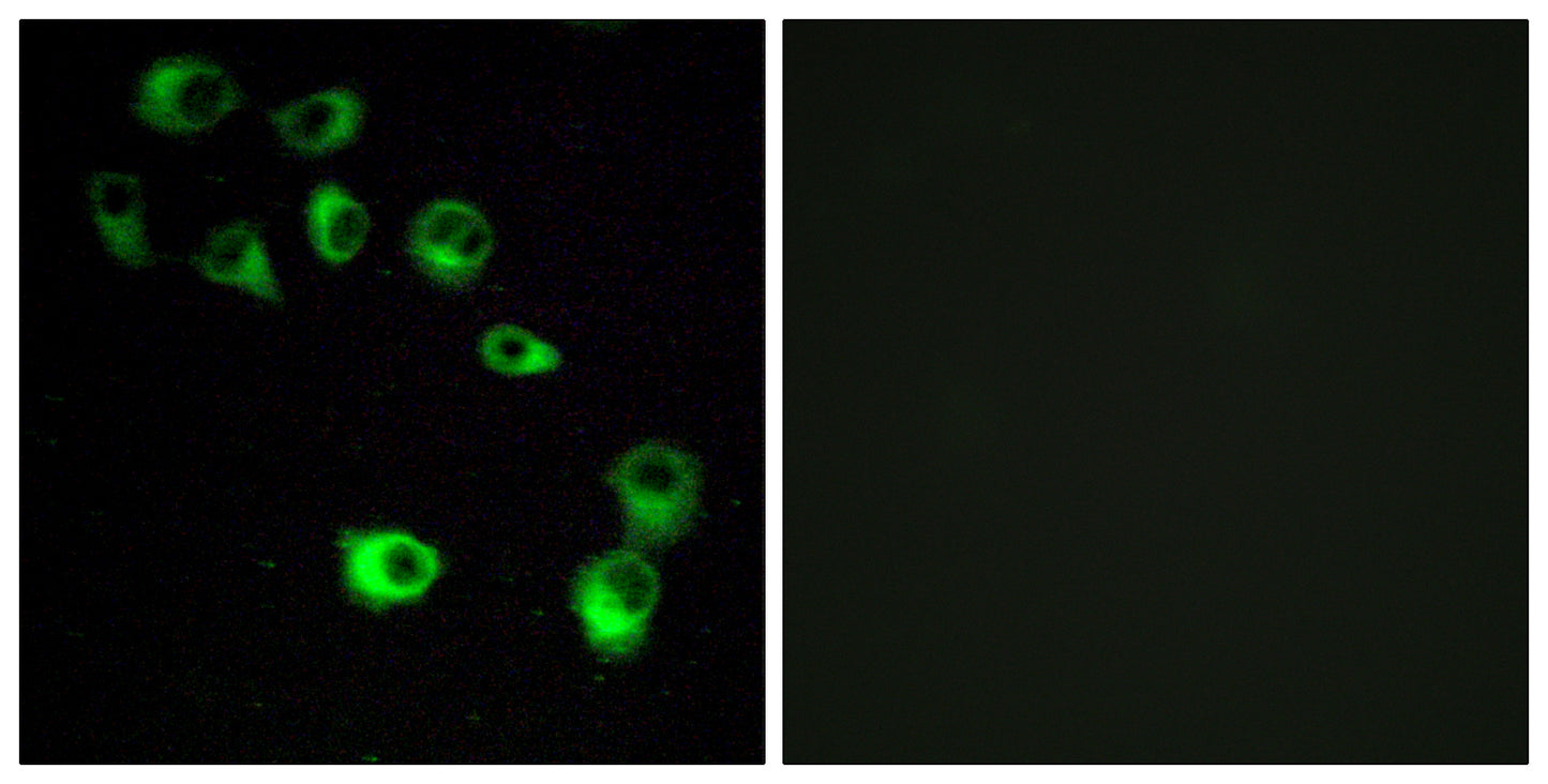 VN1R4 Rabbit Polyclonal Antibody