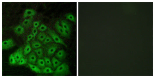 VN2R1P Rabbit Polyclonal Antibody