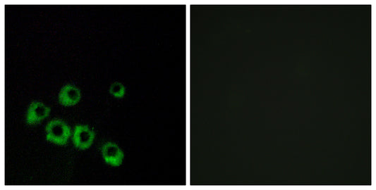 VPAC1 Rabbit Polyclonal Antibody