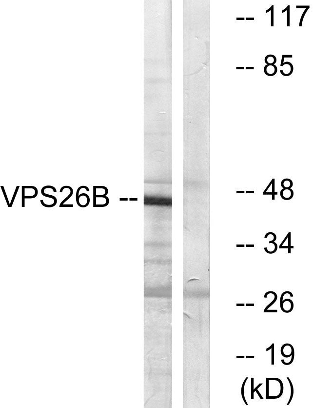 VPS26B Rabbit Polyclonal Antibody