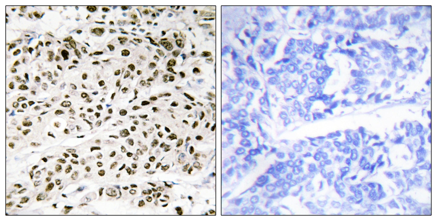 VPS72 Rabbit Polyclonal Antibody
