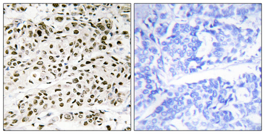 VPS72 Rabbit Polyclonal Antibody