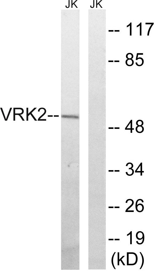 VRK2 Rabbit Polyclonal Antibody
