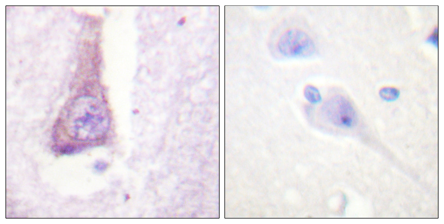 WASP Rabbit Polyclonal Antibody