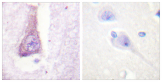 WASP Rabbit Polyclonal Antibody