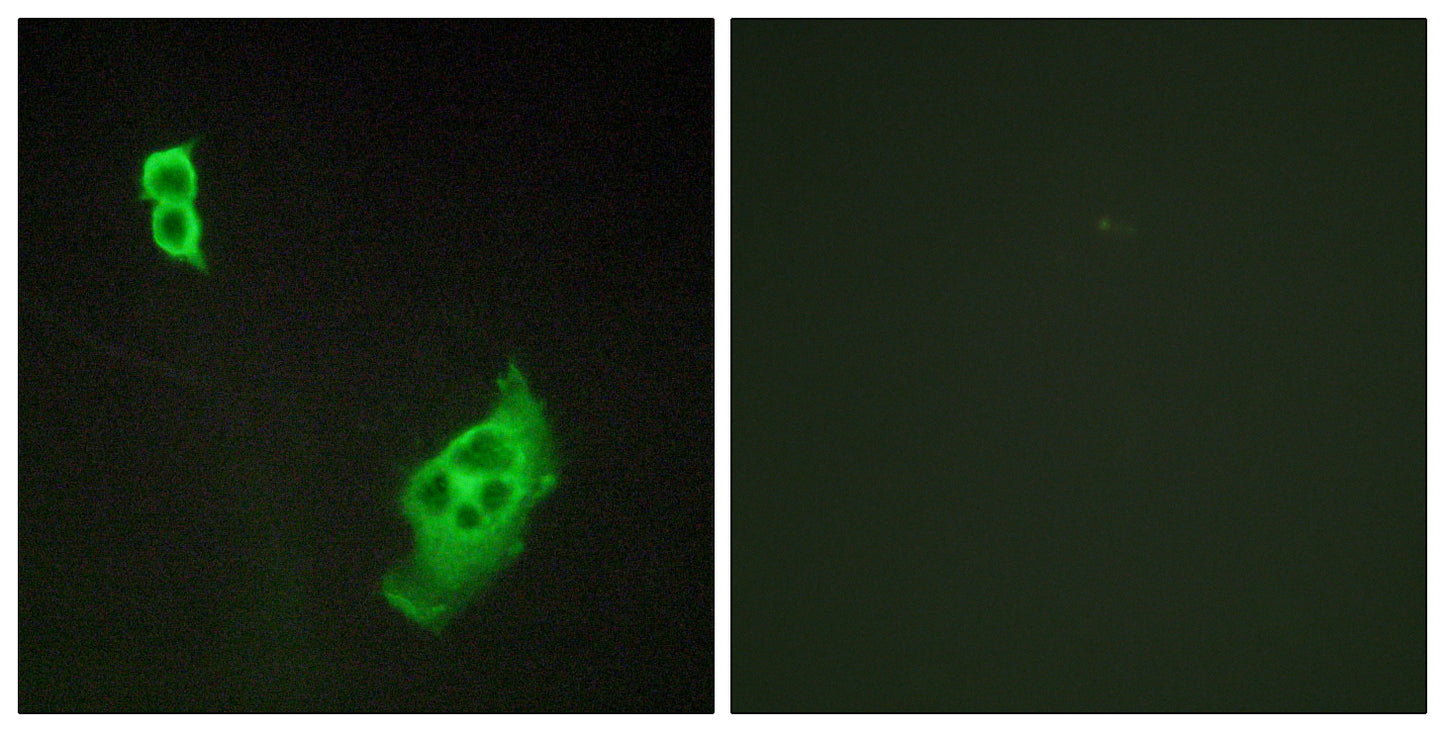 WAVE1 Rabbit Polyclonal Antibody