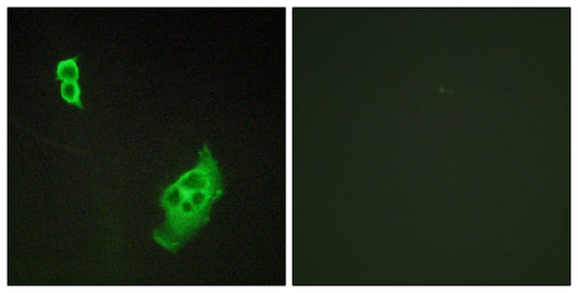 WAVE1 Rabbit Polyclonal Antibody