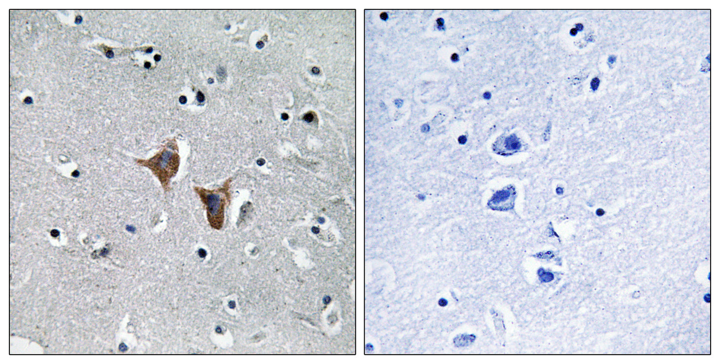 WAVE4 Rabbit Polyclonal Antibody
