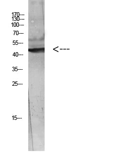 WISP-3 Rabbit Polyclonal Antibody