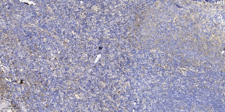 WIT1 Rabbit Polyclonal Antibody