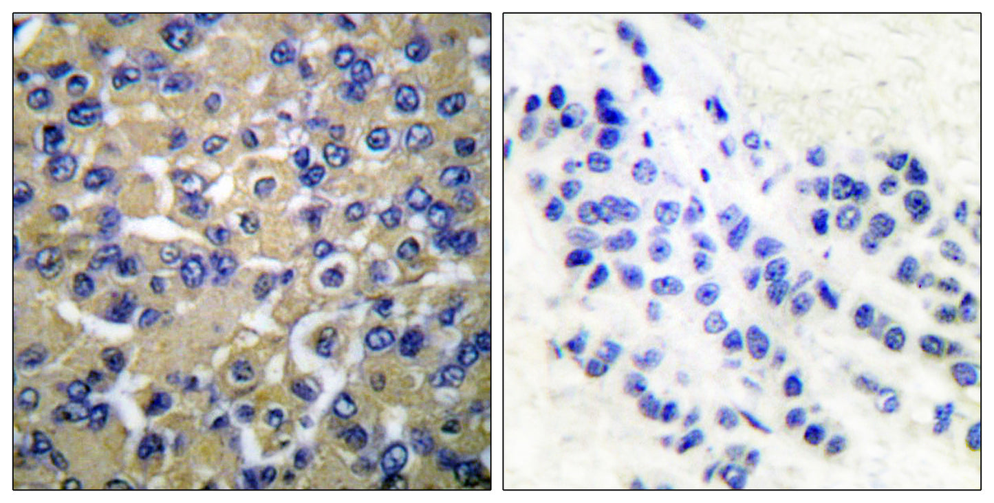 WNK1 Rabbit Polyclonal Antibody
