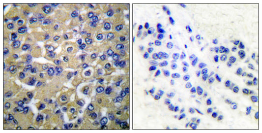 WNK1 Rabbit Polyclonal Antibody