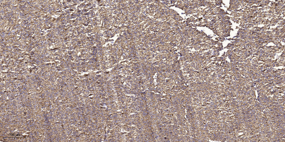 WNK2 Rabbit Polyclonal Antibody