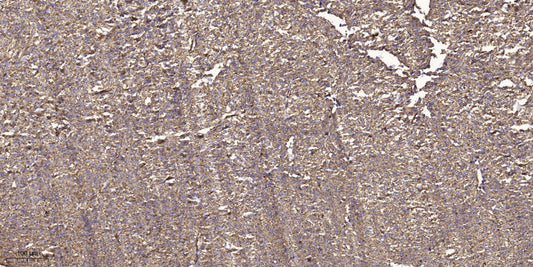 WNK2 Rabbit Polyclonal Antibody